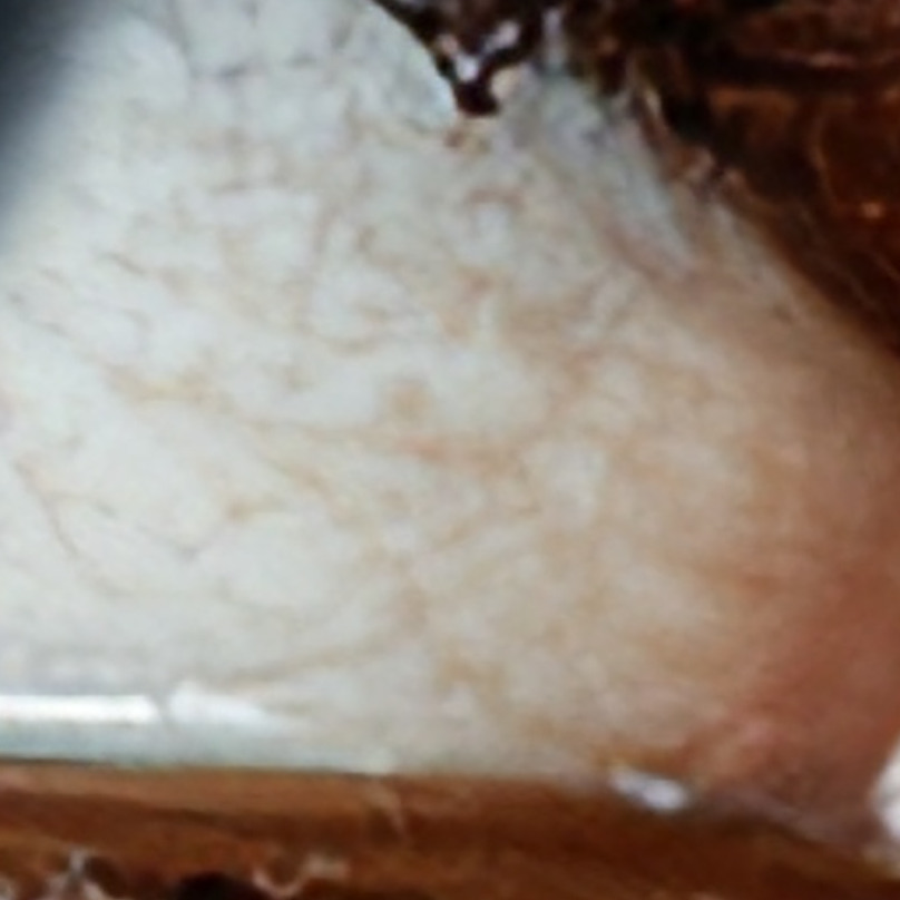 The corresponding native 808 pixel lower-right sclera crop from the 16K RTX VSR output